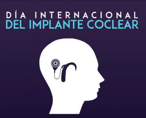 The cochlear implant in Cuba, an achievable reality
